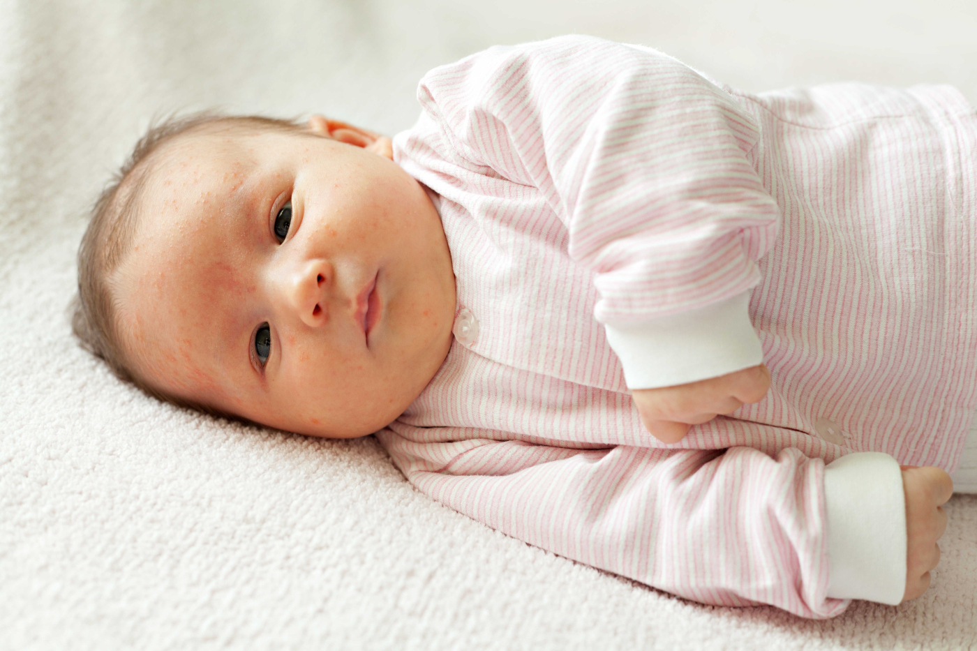 Strok Pada Bayi Baru Lahir