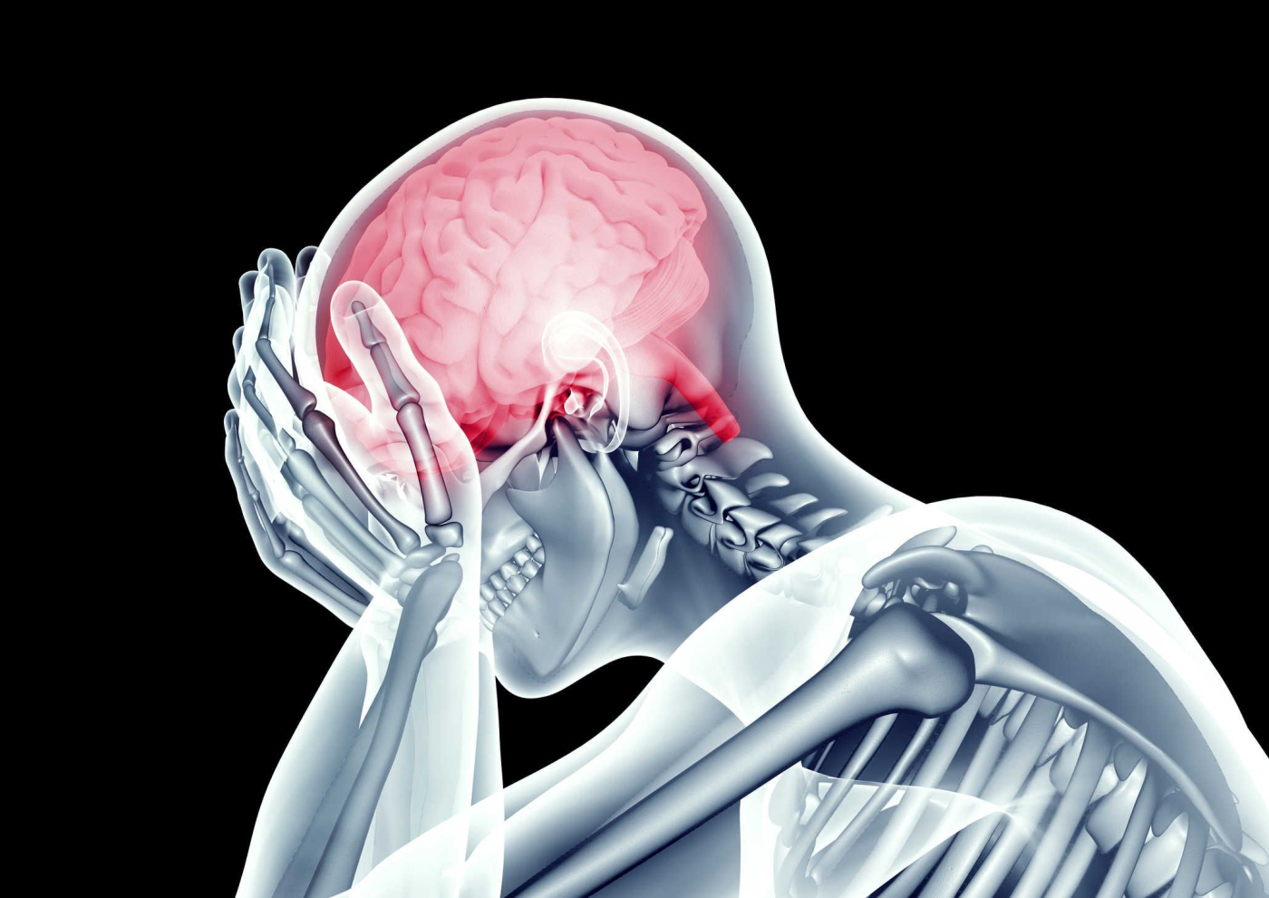 5 Fakta Mengejutkan Mengenai Migrain