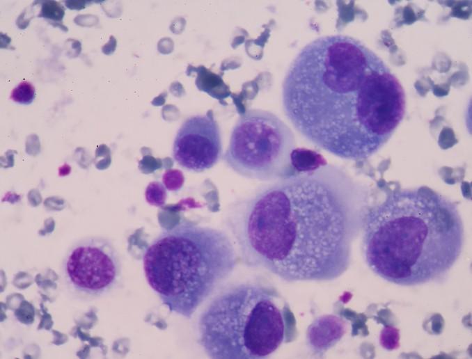 Saintis Cipta Sistem Imunoterapi Baru Untuk Kesan Sel Kanser - Kajian