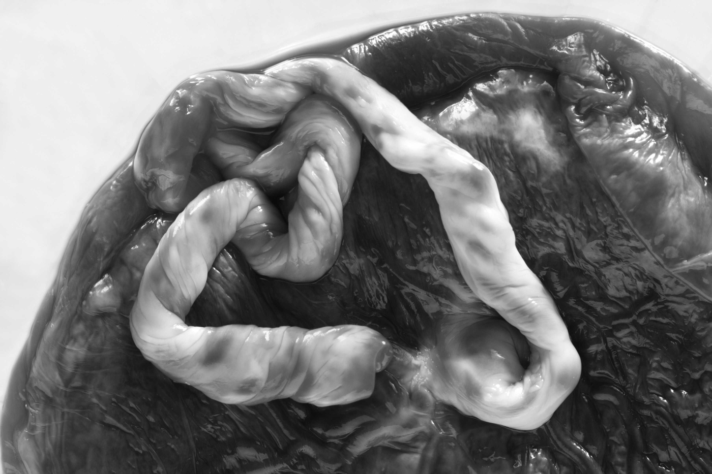 Eating Human Placenta: Health Tip or Taboo