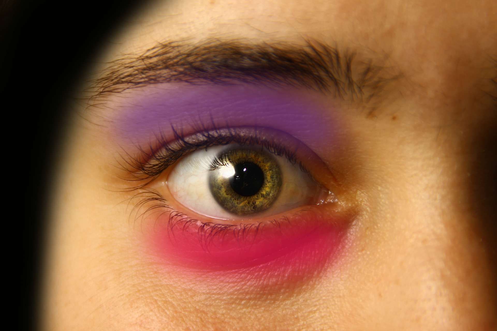 Bagaimana Menghilangkan Mata Lebam Dengan Cepat?