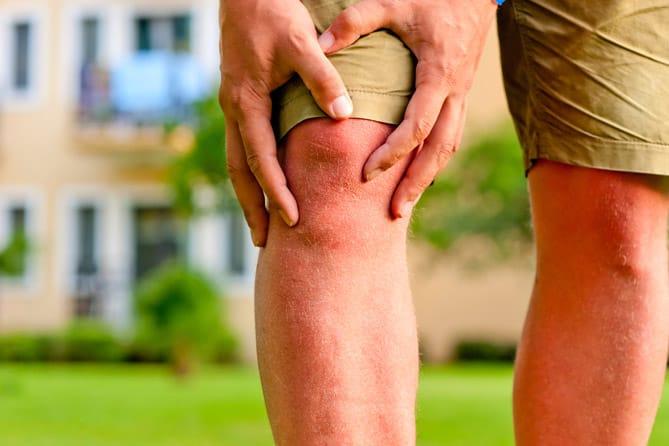 Osteoartritis. Apa Yang Perlu Anda Tahu?