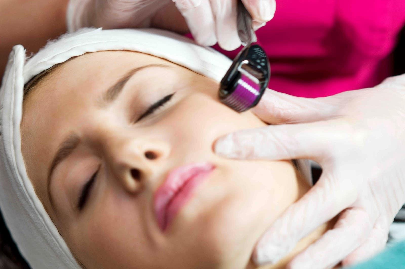 medical-skin-needling-can-stimulate-collagen-production