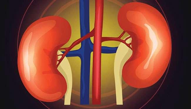 Kidney Cysts