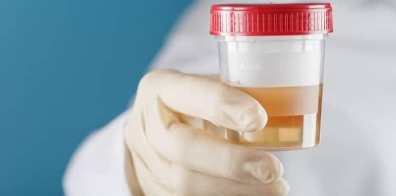 ujian-jangkitan-saluran-kencing-di-rumah