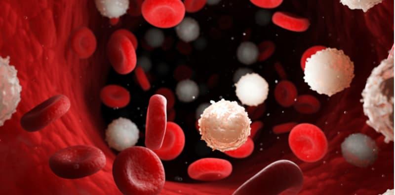 Leukemia Akut