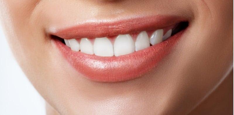 Teringin Nak Gigi Kelihatan Putih Berseri, Ini 3 Cara Semula Jadi Melakukannya Di Rumah