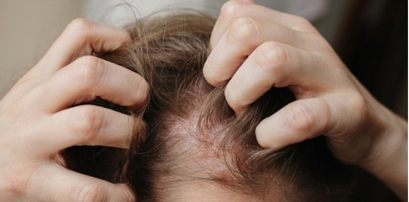 7-cara-dapatkan-kulit-kepala-yang-sihat-dan-rambut-yang-panjang