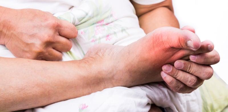 4-jenis-makanan-perlu-dielakkan-oleh-pesakit-gout