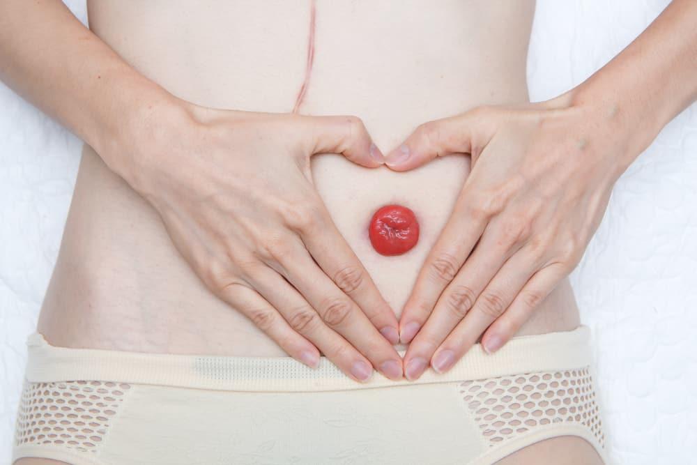 Bolehkah Pesakit dengan Stoma Berpuasa?