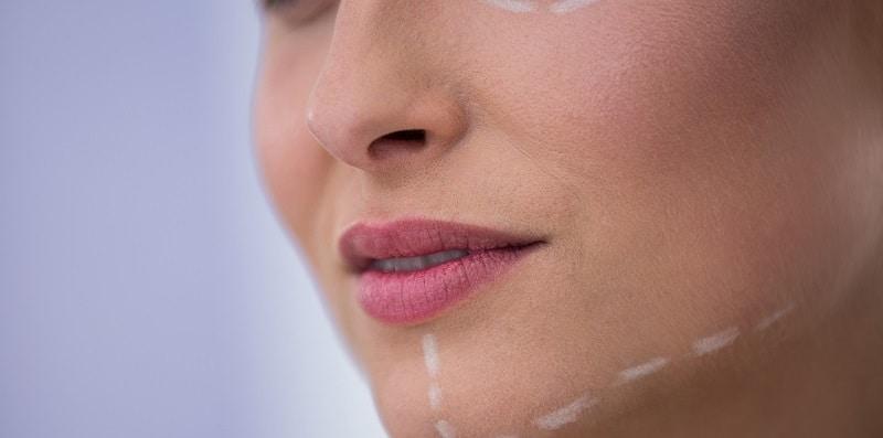 pembetulan-tulang-rahang