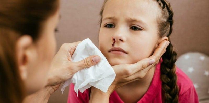 kanak-kanak-hidung-berdarah