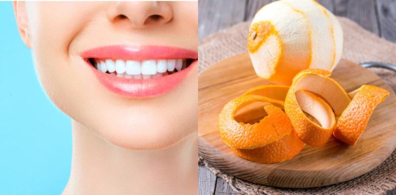5-cara-semula-jadi-memutihkan-gigi