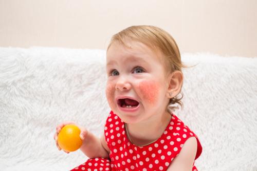 4 Cara Mengetahui Anak Mengalami Alahan Makanan