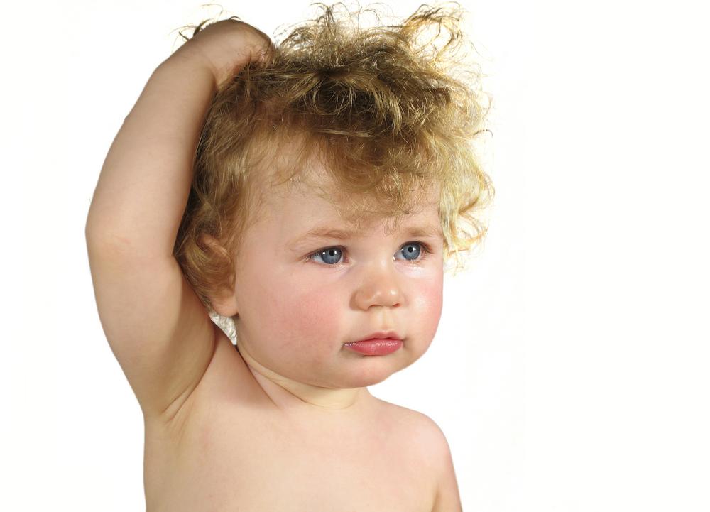 trichotillomania-bila-anak-anda-obses-menarik-rambut