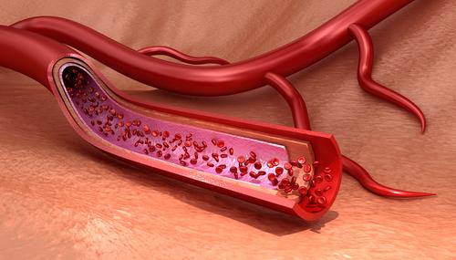 5 Cara Meningkatkan Hemoglobin Secara Semula Jadi