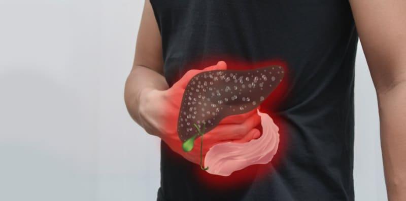 Kondisi Hati Berlemak, Beberapa Perkara Asas Anda Perlu Tahu Tentangnya!