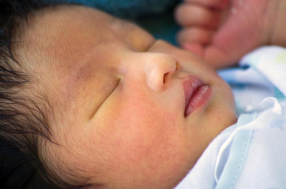 Susu Ibu: Merawat atau Menyebabkan Bayi Kuning?