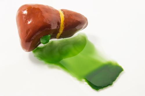 Hepatitis Toksik Akibat Amalan Seharian