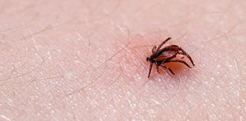 Kutu Bukan Sahaja Ada Pada Rambut Malah Pada Badan Juga! Apa Bahayanya?