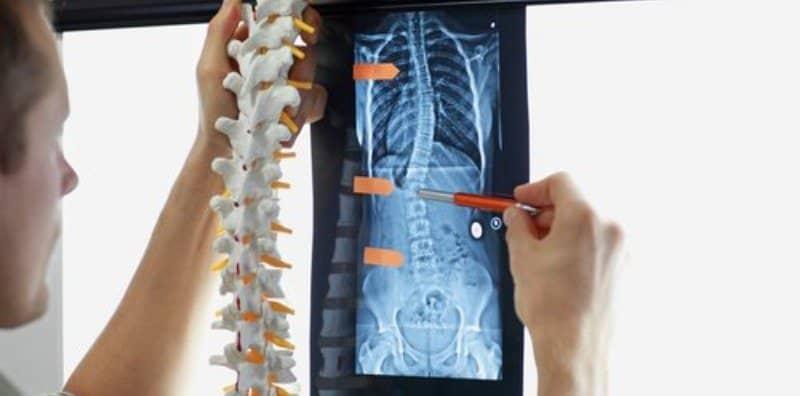 5 Perkara Penting Anda Perlu Titik Berat Jika Ada Sakit Tulang Belakang Ini!