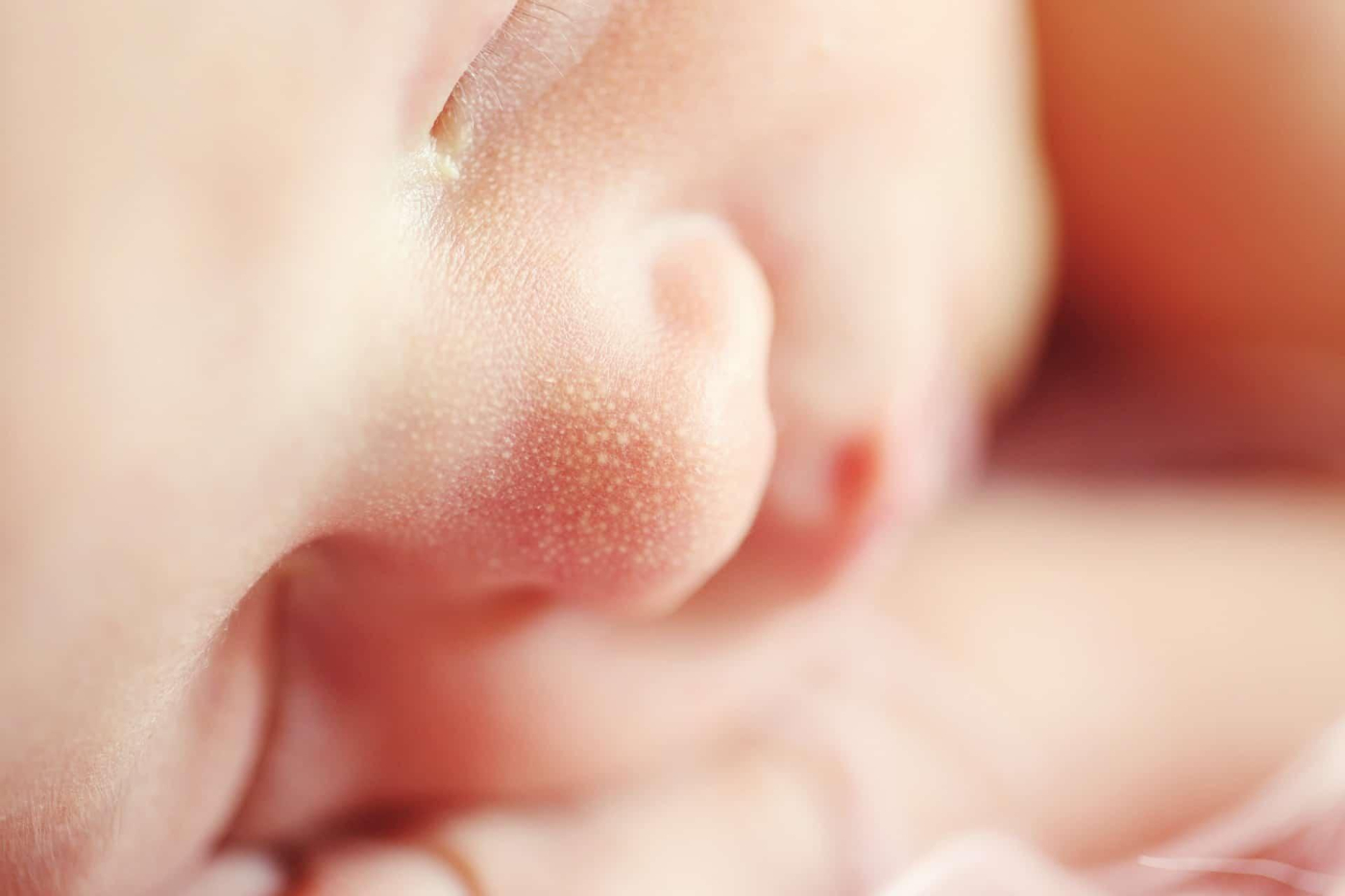 Jenis Kecacatan Mata pada Bayi Baru Lahir