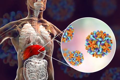 Hepatitis C: Diagnosis Awal Cegah Kematian