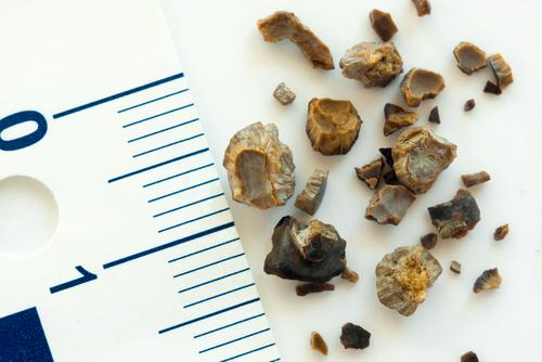 Batu Karang: Berapakah Tempoh untuk Melepasinya?