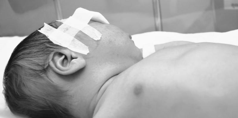 Terkejut Anak Yang Baru Lahir Ada Talasemia, Ini Komplikasi & Risiko Yang Boleh Terjadi