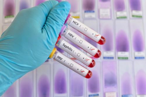 Hubungan Antara HIV dan Jangkitan Hepatitis C