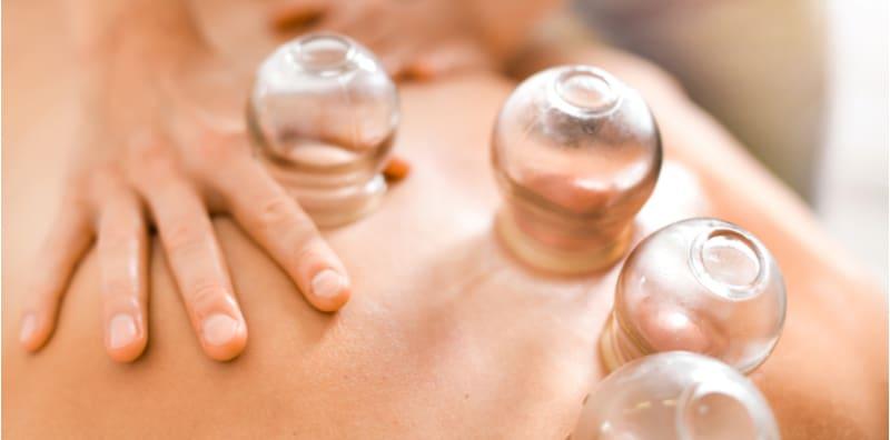 Ada Apa Dengan Bekam? Berkesan Atau Tidak? Ini Dapatan Kajian