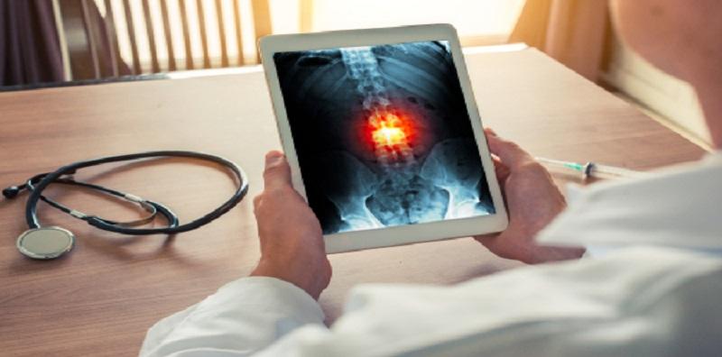 Metastasis Tulang, Risiko Yang Boleh Dialami Pesakit Barah!