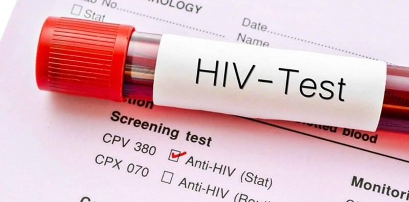 10 Tanda AMARAN Anda Mungkin Terkena Jangkitan HIV, 1 Dari 8 Orang Berisiko