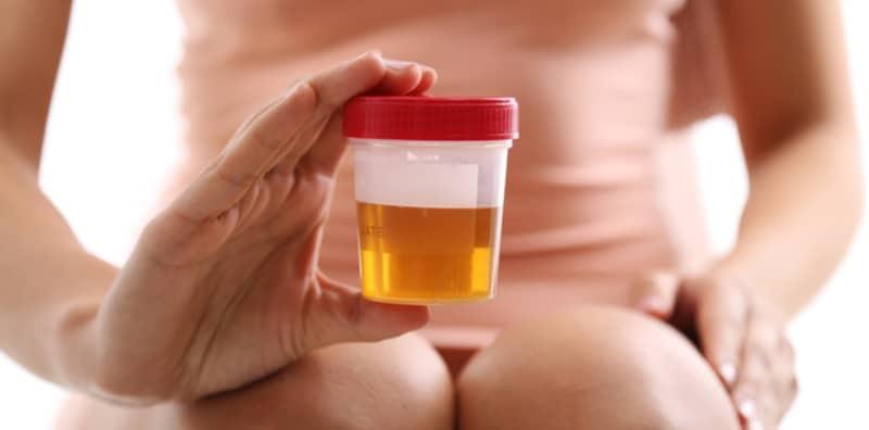 warna-bau-air-kencing