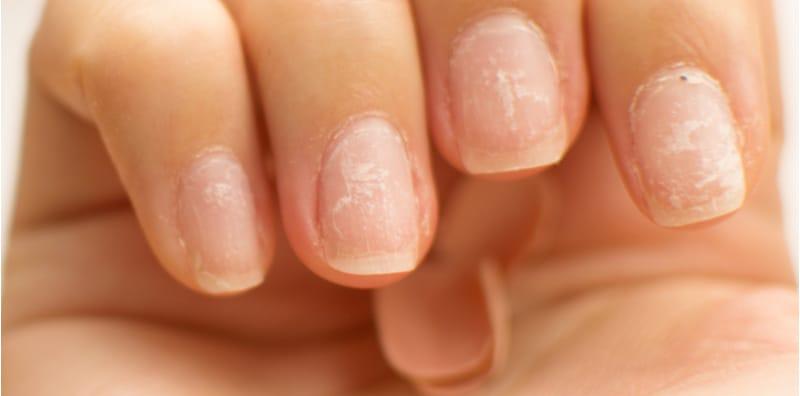 Kuku Petanda Anda Sihat Atau Tidak, Semak 9 Penyakit Ini Melalui Kuku!