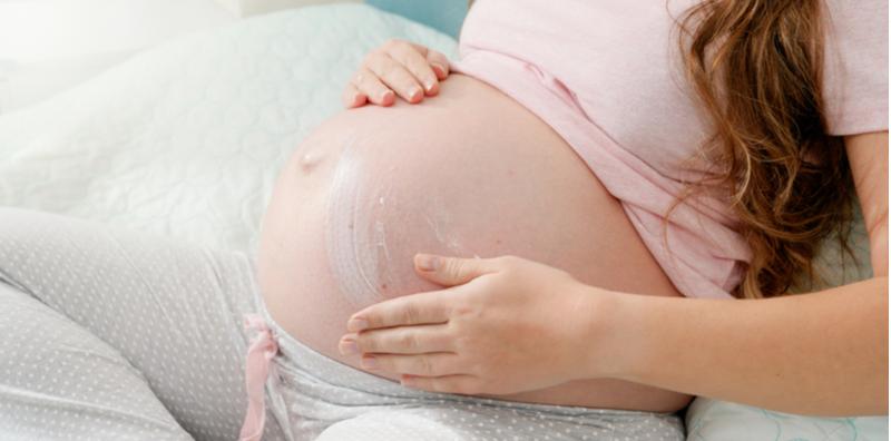 rawatan-psoriasis-ketika-hamil