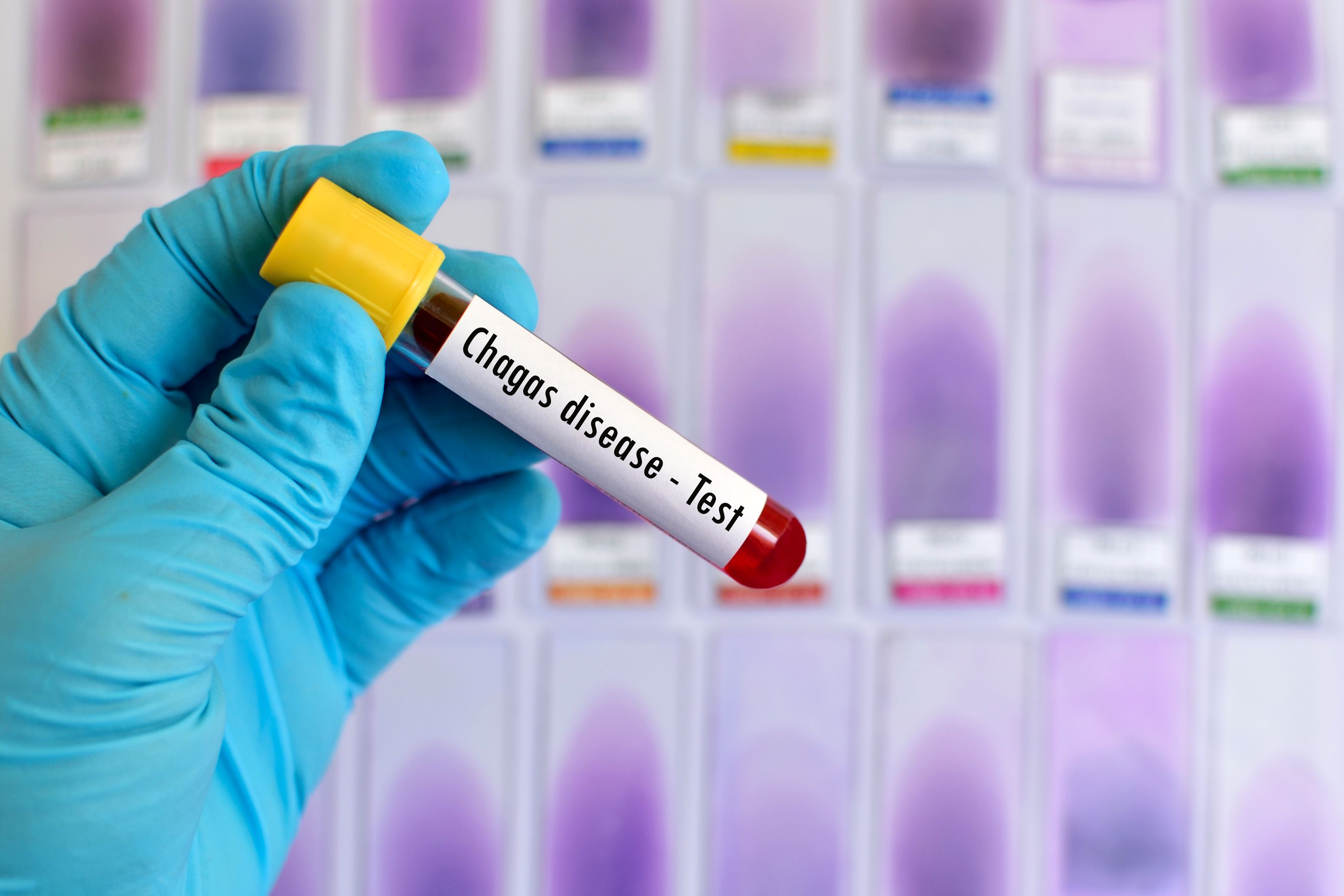 penyakit-chagas-jangkitan-parasit-bawaan-pepijat