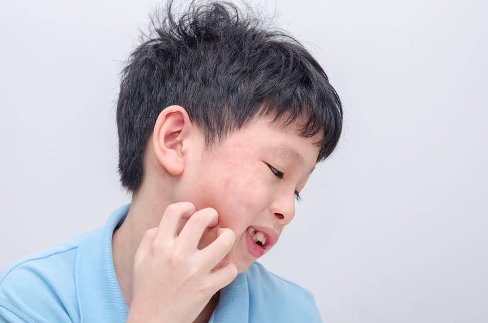 Jangan Ambil Mudah Penyakit Beguk Pada Anak, Ini Bahaya Yang Menanti!