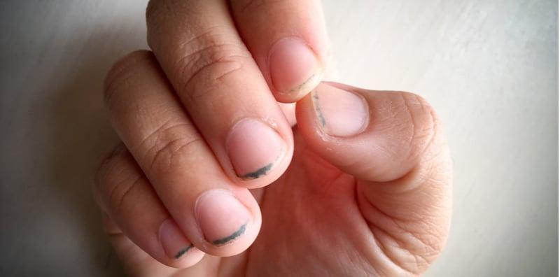 Jangan Biarkan Kuku Hitam! Ini Cara Betul Penjagaan Kuku Tangan & Kaki