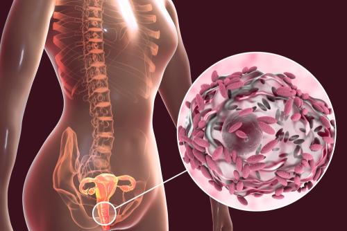 Mengenai Bakteria Vaginosis