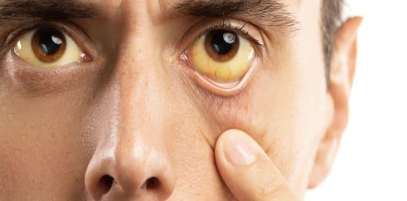 keadaan-mata-dan-tahap-kesihatan