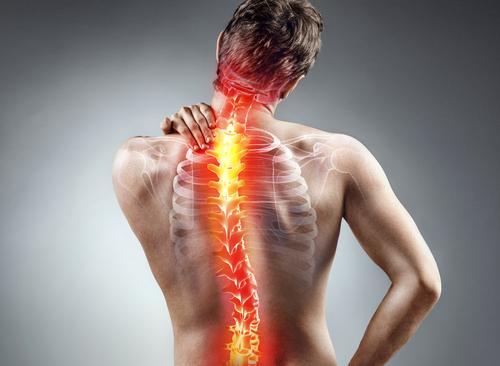 'Familial Chordoma': Tumor Di Tulang Tengkorak dan Tulang Belakang