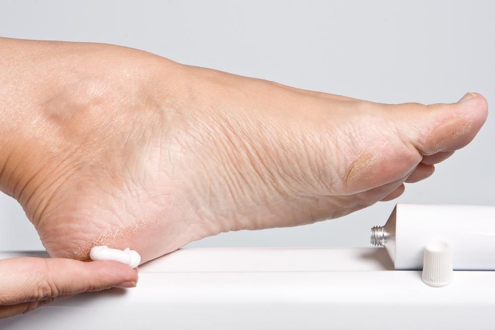 Diabetes Self-Care: 5 Ways to Soothe Dry, Itchy Skin