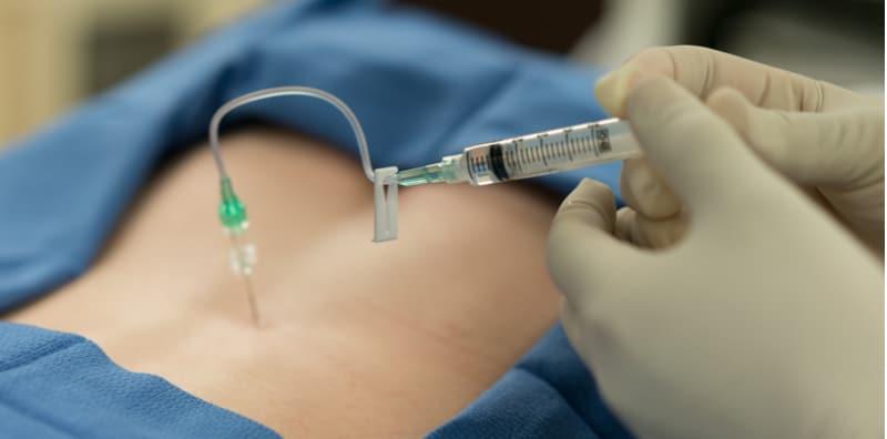 manfaat-dan-risiko-epidural-semasa-kelahiran