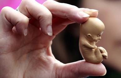 Kaitan Pengguguran Bayi dan Kesihatan Mental