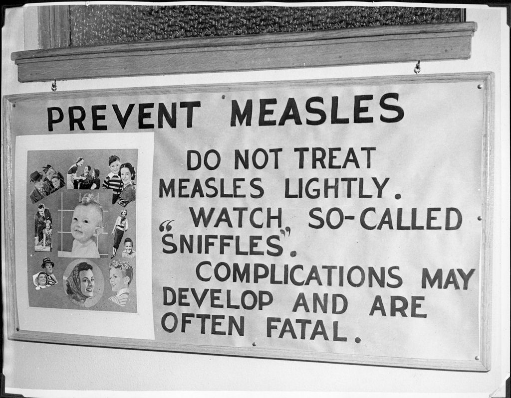 First Measles Case in Costa Rica After 5 Years Due To Unvaccinated Tourist