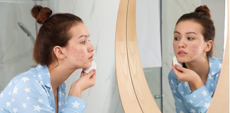 Resah Bila Memiliki Kulit Bermasalah, Ambil Tahu Puncanya Dan Penjagaan Yang TEPAT