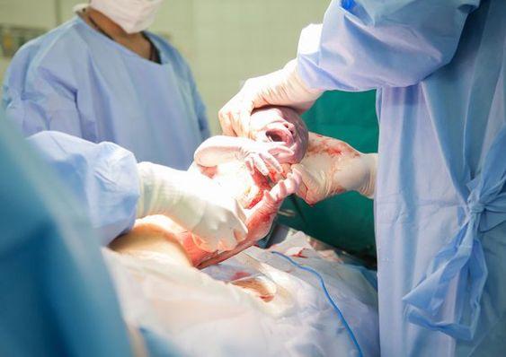 Apakah Pengalaman Bersalin Pilihan Anda: Adakah Normal Atau Caesarean?