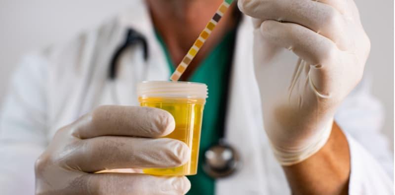 Ada Protein Dalam Air Kencing? AWAS! Ini Bahaya Untuk Buah Pinggang Anda
