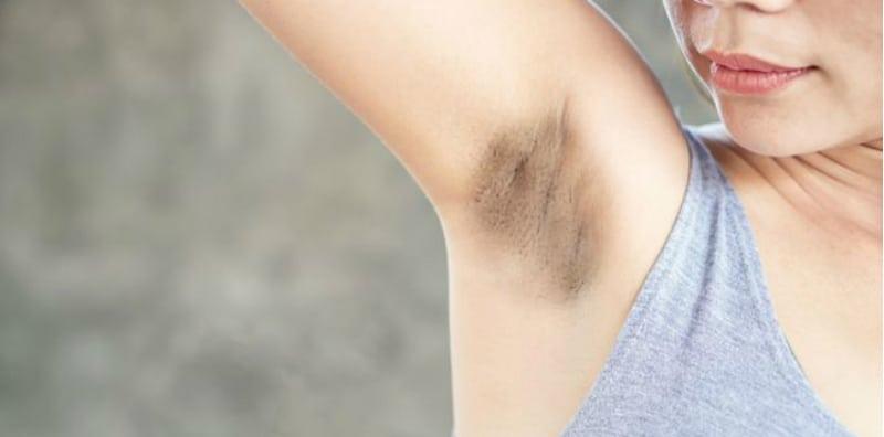awas-ketiak-hitam-merupakan-petanda-penyakit-berbahaya